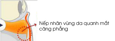lay da mo thua mi duoi 1